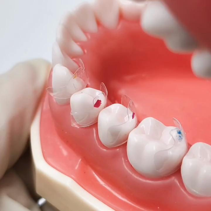 10 buc/ 20 buc/ 40 buc Benzi matrice transparente dentare Matrice transparente Compozit molar posterior Clasa restauratoare 4.5/5.5/6.5/8.0 Se potriveste Bioclear