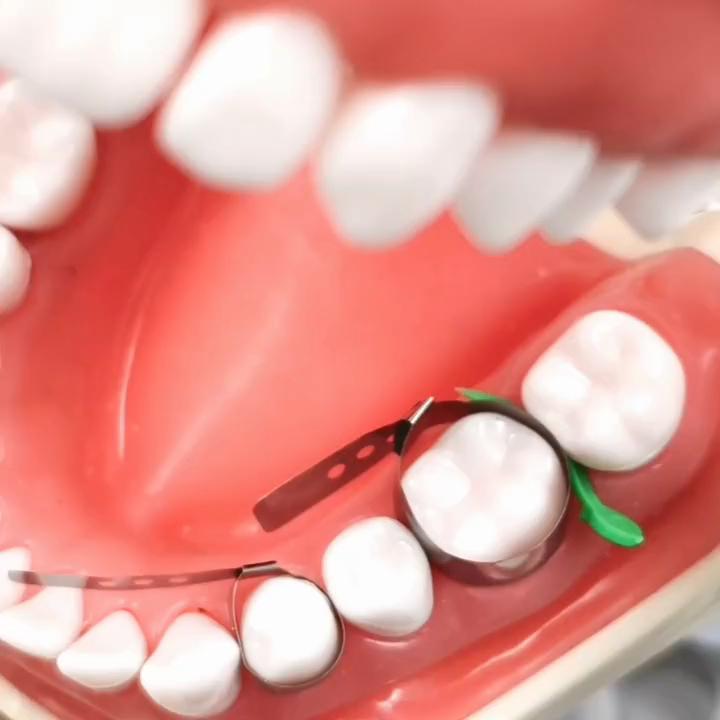 1 confezione Fasce Matrici Dentali Regolabili Strisce Dentali Matrici Cervicali Matrici Sezionali Contornate Materiale Matrice
